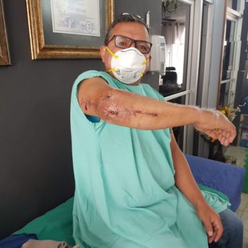 HONDURAS / PERIODISTA GEOVANNY SIERRA FUE HERIDO EN REPRESIÓN ¡SALVÉMOSLE EL BRAZO! HONDURAS / PERIODISTA GEOVANNY SIERRA FUE HERIDO EN REPRESIÓN ¡SALVÉMOSLE EL BRAZO!