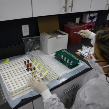 COMBINACIÓN SPUTNIK-ASTRAZENECA ES VIABLE, SEGÚN ENSAYO EN ARGENTINA